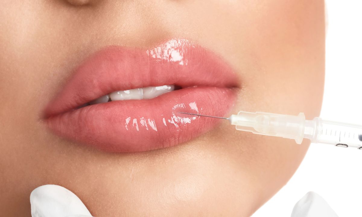 Lip fillers in Darien CT